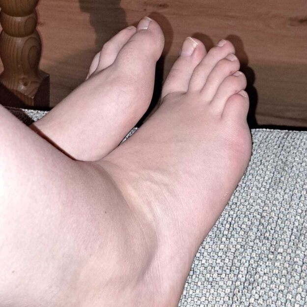 Dirtytoes