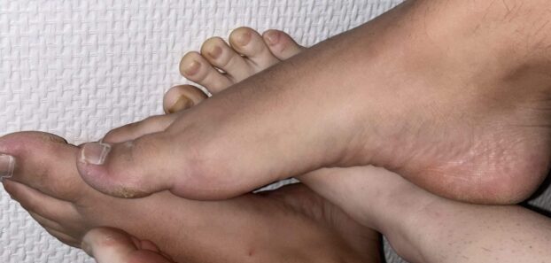 Feetinas