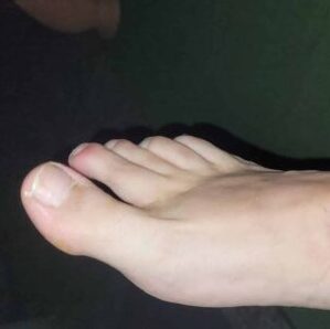 Famousfeet